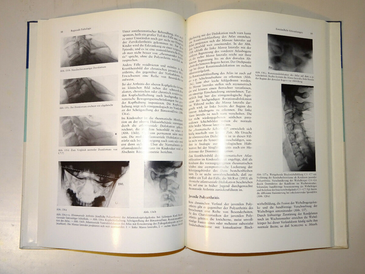 Torklus/Gehle: Die obere Halswirbelsäule, Morphologie. Thieme, 2.Auflage 1975