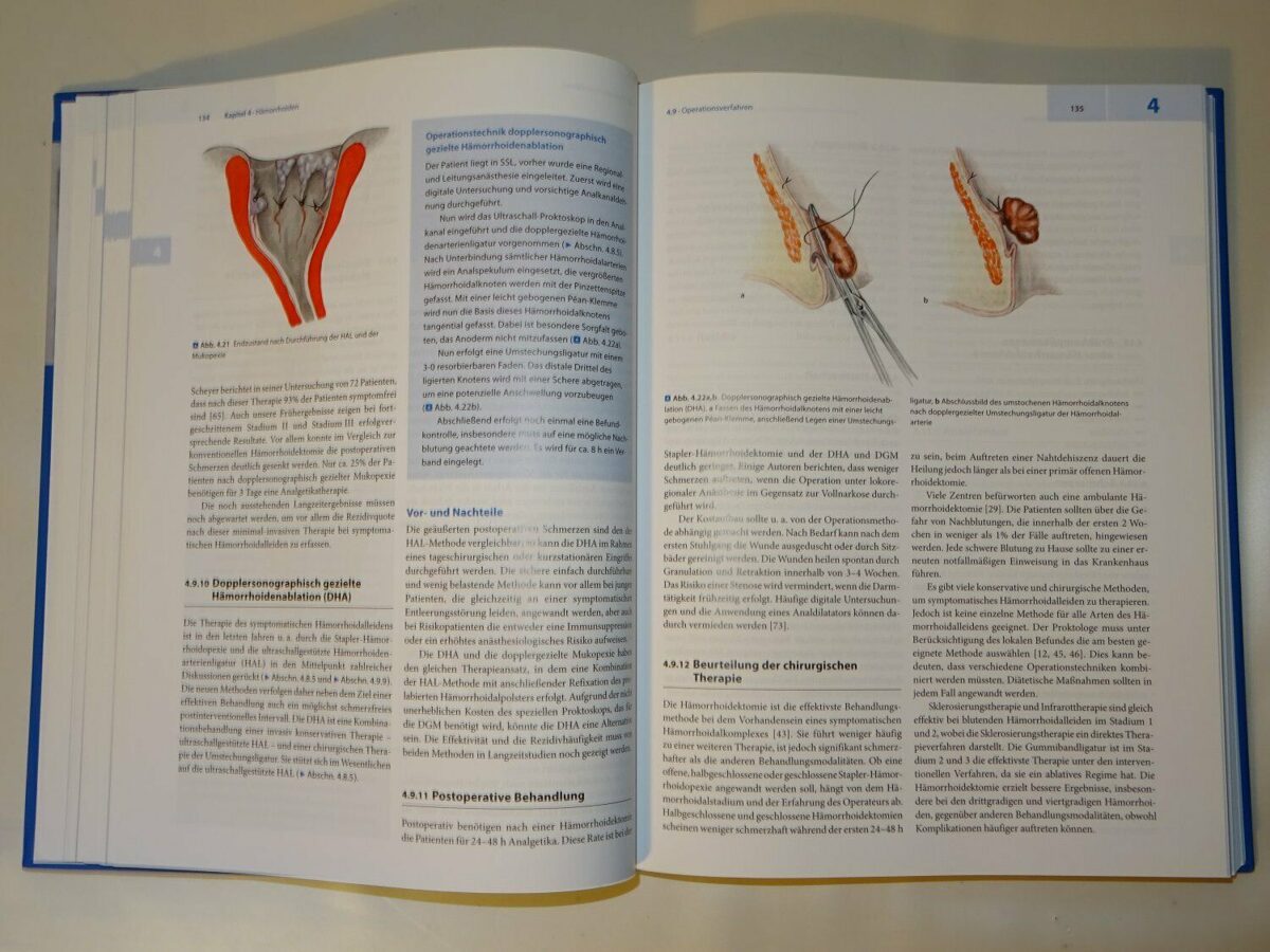 Lange, Mölle, Girona: Chirurgische Proktologie 2.Auflage Springer-Verlag 2012