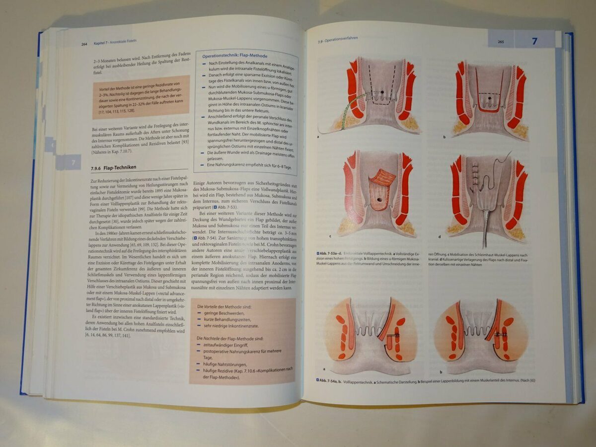 Lange, Mölle, Girona: Chirurgische Proktologie Springer-Verlag 2006
